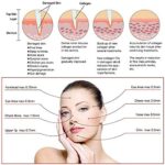 ⁦Dr.Pen ULTIMA M5 Derma  - قلم ديرما بن للشعر دكتور بن ام 5 بنظام الإبرة الدقيقة الأوتوماتيكية وأطوال إبر قابلة للتعديل⁩ - الصورة ⁦5⁩
