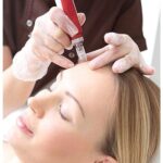 ⁦Enzo Derma Pen - 5 Speeds - اينزو ديرما بن للوجه لتنقيه و تجديد خلايا البشرة⁩ - الصورة ⁦2⁩