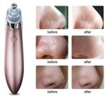 ⁦جهاز ازالة البثور السوداء Dobet Facial Pores Cleaner Blackhead Removal⁩ - الصورة ⁦3⁩