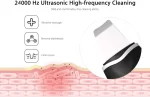 ⁦جهاز الالتراسونيك لتنظيف البشرة بعمق - Ultrasonic Skin Scrubber⁩ - الصورة ⁦3⁩