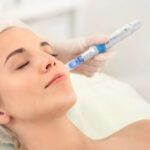 ⁦ديرما بن a6 دكتور بن - Dr.Pen-Ultima A6 Derma Pen⁩ - الصورة ⁦4⁩